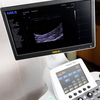 УЗИ аппарат SIUI Apogee 3500