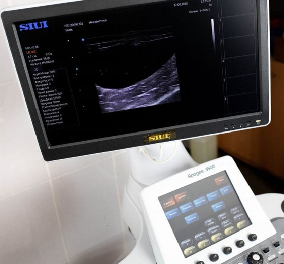 УЗИ аппарат SIUI Apogee 3500